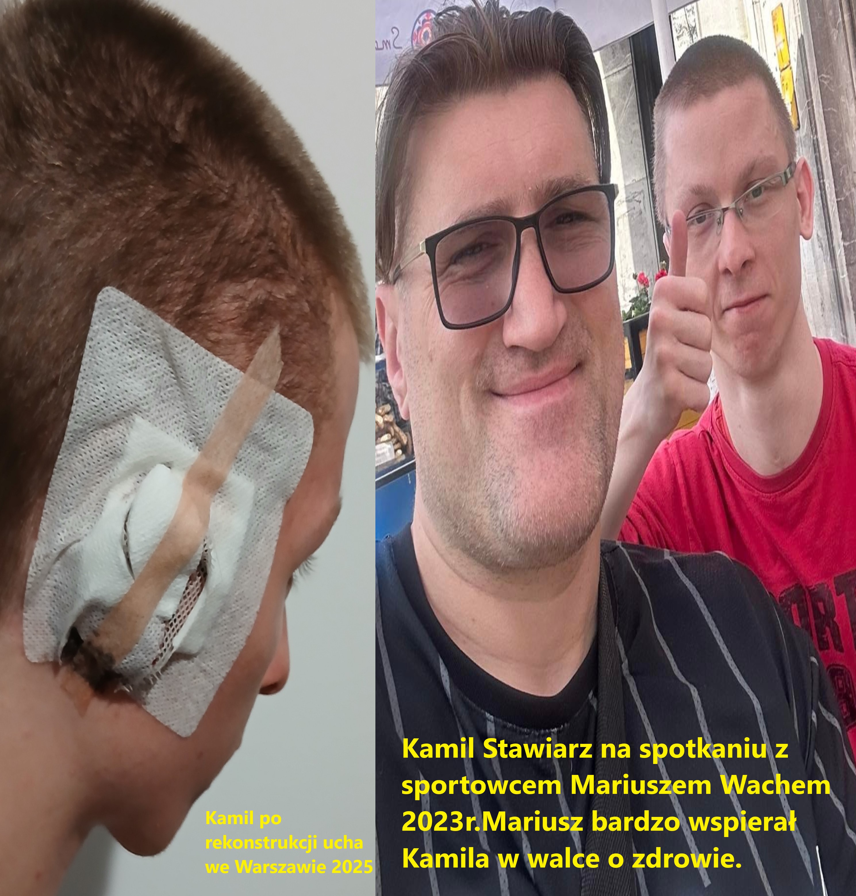 Usunięto obraz.