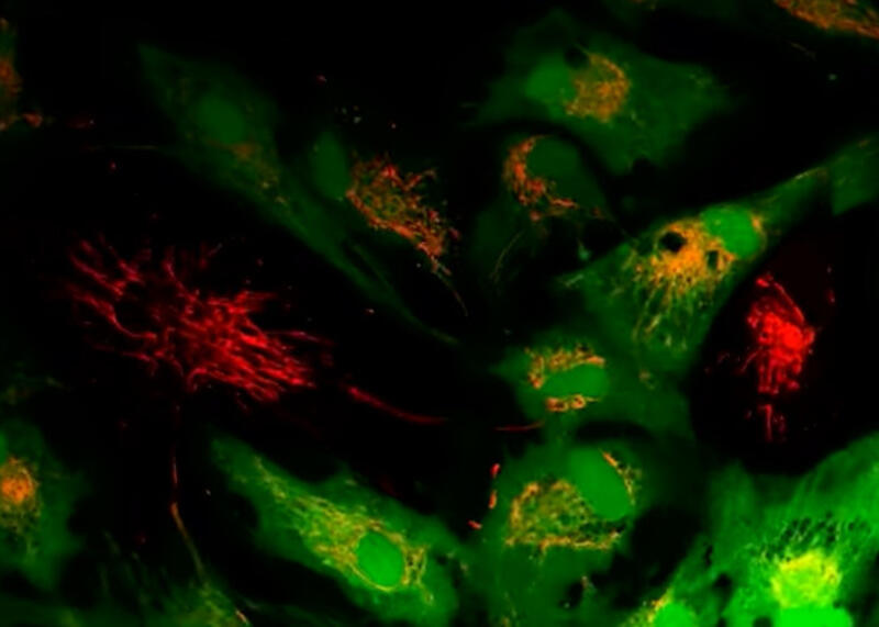 mitochondria