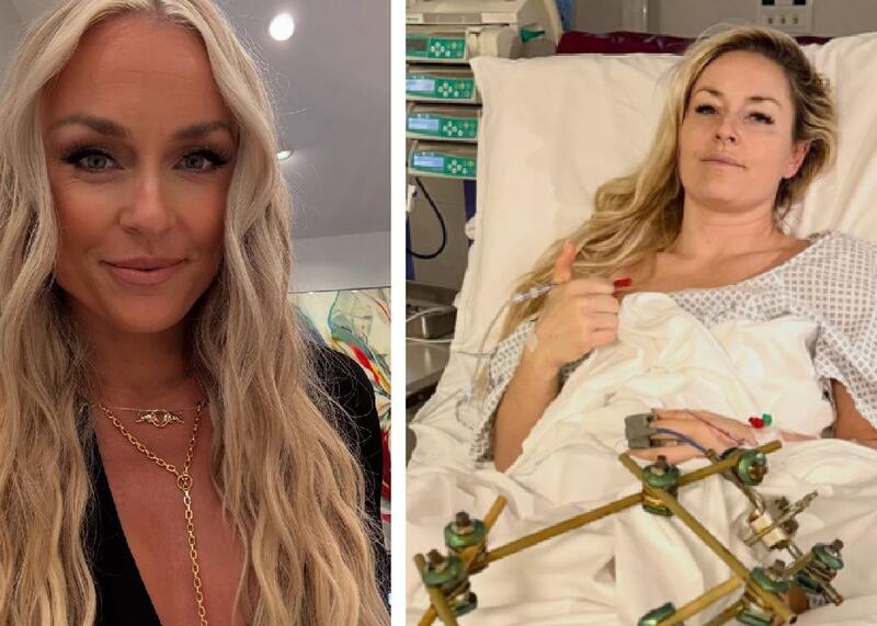 Lindsey Vonn po 8 operacjach